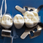 Cunei trasparenti riflettenti TDV - immagine 2