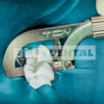 SEGHETTO STRIPPING MICROCUT TDV - immagine 3