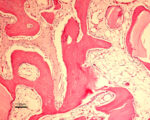 Gel 40 collagene siringa da 0,5 cc Osteobiol TG405 - immagine 3