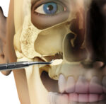 Apatos mix flacone da 2,0 gr. Osteobiol TAP20 - immagine 3