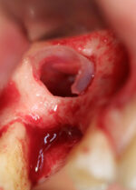 Membrana Special essiccata equina x-fine mm 20X20 Osteobiol TSPX20E - immagine 4