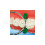 Cunei elastici kit TDV - immagine 4