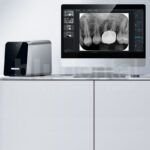 Free Scan scanner digitale per la radiografia intraorale Woodpecker - immagine 2