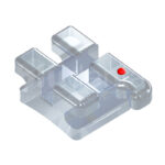 Attacchi estetici in zaffiro Polar 1 caso Sia Orthodontic
