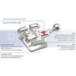 Attacchi metallici basso profilo Evolution Kit 1 caso Sia Orthodontic - immagine 2