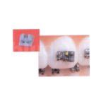 Cunei di rotazione Sia Orthodontic