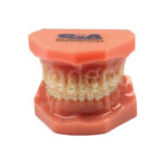 Modello dimostrativo con attacchi in ceramica Typodont Sia Orthodontic