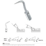 Inserto ablatore perio compatibile modello P4-PD4